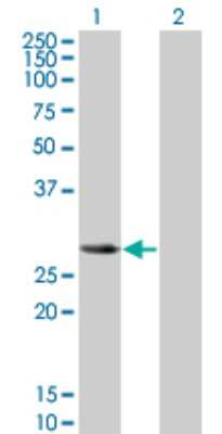 Western Blot: SLA2 Antibody (3G5) [H00084174-M01]