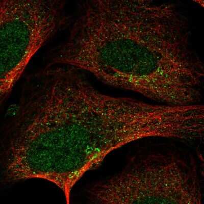 Immunocytochemistry/ Immunofluorescence: SLA2 Antibody [NBP2-55334]