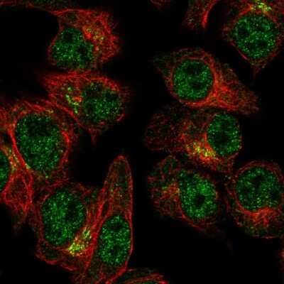 Immunocytochemistry/ Immunofluorescence: SLA2 Antibody [NBP2-56708]