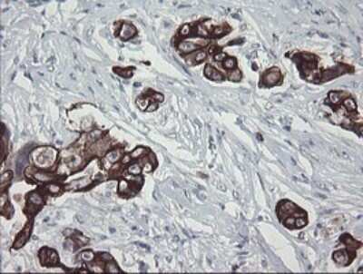 Immunohistochemistry: SLA2 Antibody (OTI3A7) - Azide and BSA Free [NBP2-74210]