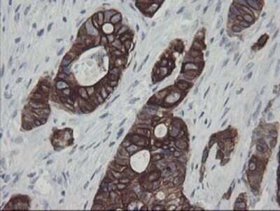 Immunohistochemistry: SLA2 Antibody (OTI3A7) - Azide and BSA Free [NBP2-74210]