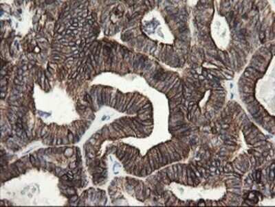 Immunohistochemistry: SLA2 Antibody (OTI3A7) - Azide and BSA Free [NBP2-74210]