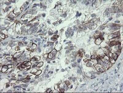 Immunohistochemistry: SLA2 Antibody (OTI3A7) - Azide and BSA Free [NBP2-74210]