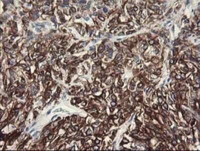 Immunohistochemistry: SLA2 Antibody (OTI3A7) - Azide and BSA Free [NBP2-74210]