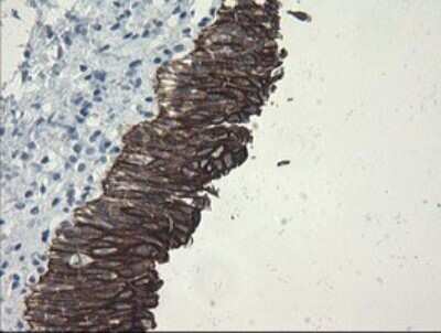 Immunohistochemistry: SLA2 Antibody (OTI3A7) - Azide and BSA Free [NBP2-74210]