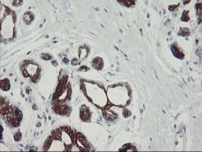 Immunohistochemistry: SLA2 Antibody (OTI3A7) - Azide and BSA Free [NBP2-74210]