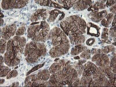 Immunohistochemistry: SLA2 Antibody (OTI3A7) - Azide and BSA Free [NBP2-74210]