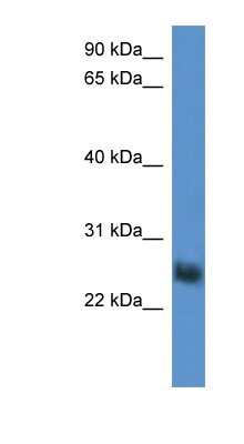 Western Blot: SLA2 Antibody [NBP1-79830]