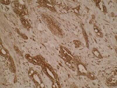Immunohistochemistry: SLA2 Antibody (Z30P1F12*F4) - BSA Free [NBP2-50293]