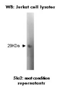 Western Blot: SLA2 Antibody (Z30P1F12*F4)BSA Free [NBP2-50293]