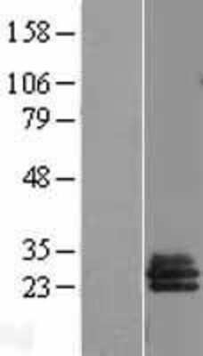 Western Blot: SLA2 Overexpression Lysate [NBL1-15998]