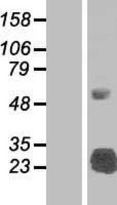 Western Blot: SLA2 Overexpression Lysate [NBP2-05079]