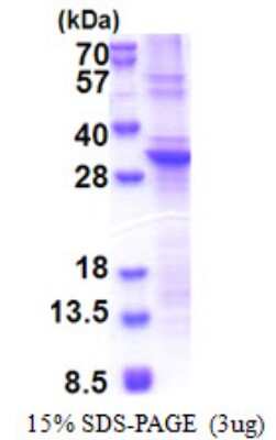 SDS-PAGE: Recombinant Human SLA2 His Protein [NBP2-22823]