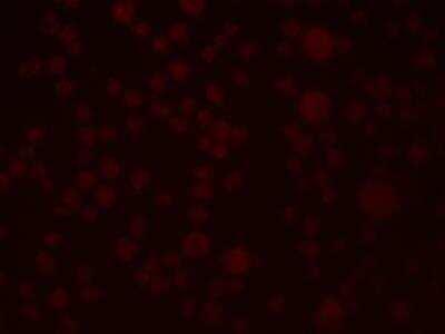 Immunocytochemistry/ Immunofluorescence: SLAIN1 Antibody - BSA Free [NBP2-81828]