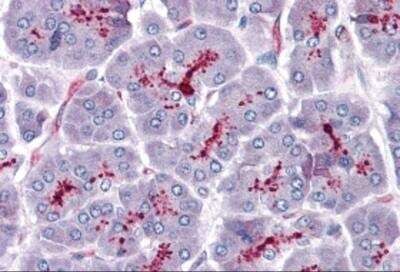 Immunohistochemistry: SLAIN1 Antibody - BSA Free [NBP2-81827]