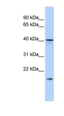 Western Blot: SLAIN1 Antibody [NBP1-70704]