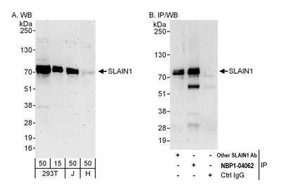 Western Blot: SLAIN1 Antibody [NBP2-04062]