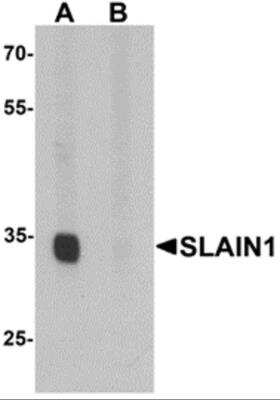 Western Blot: SLAIN1 AntibodyBSA Free [NBP2-81828]