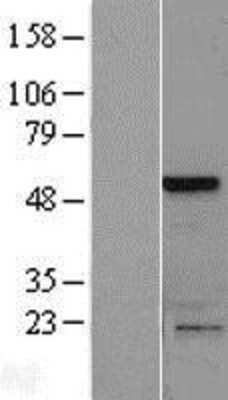 Western Blot: SLAIN1 Overexpression Lysate [NBP2-05552]
