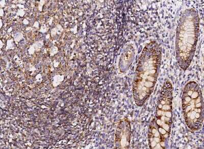 Immunohistochemistry-Paraffin: SLAM/CD150 Antibody (8) [NBP2-89678]