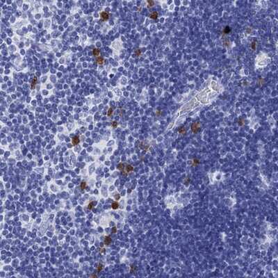 Immunohistochemistry-Paraffin: SLAM/CD150 Antibody [NBP2-62662]