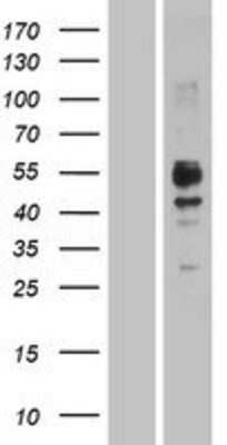 Western Blot: CRACC/SLAMF7 Overexpression Lysate [NBP2-04383]