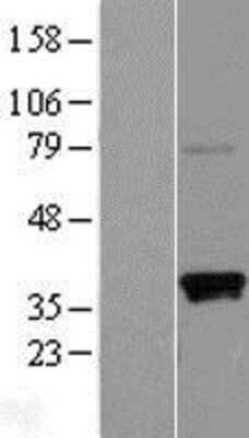 Western Blot: CD2F-10/SLAMF9 Overexpression Lysate [NBL1-16001]