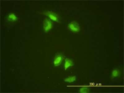 Immunocytochemistry/ Immunofluorescence: SLBP Antibody (2C4-1C8) [H00007884-M01]