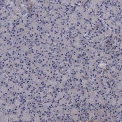 Immunohistochemistry-Paraffin: SLBP Antibody [NBP1-83290]