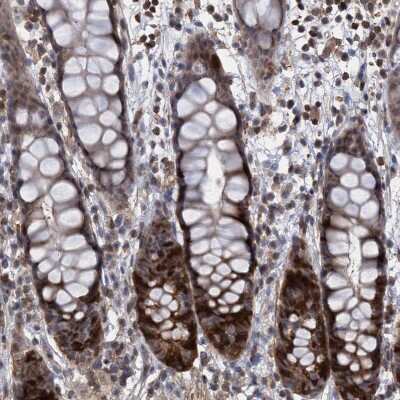 Immunohistochemistry-Paraffin: SLBP Antibody [NBP1-83290]
