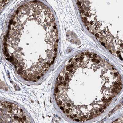 Immunohistochemistry-Paraffin: SLBP Antibody [NBP1-83290]