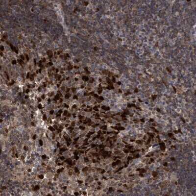 Immunohistochemistry-Paraffin: SLBP Antibody [NBP1-83290]