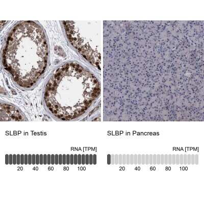 Immunohistochemistry-Paraffin: SLBP Antibody [NBP1-83290]
