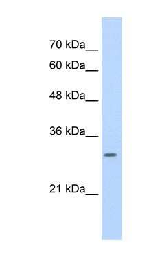 Western Blot: SLBP Antibody [NBP1-57135]