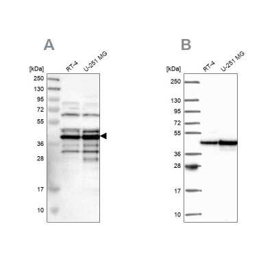 Western Blot: SLBP Antibody [NBP1-83290]