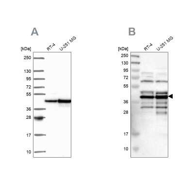 Western Blot: SLBP Antibody [NBP2-56007]