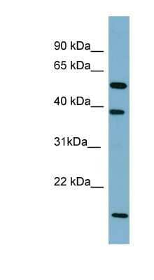 Western Blot: SLC10A1 Antibody [NBP1-60109]