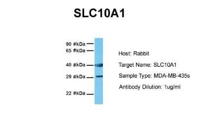 Western Blot: SLC10A1 Antibody [NBP1-60109]