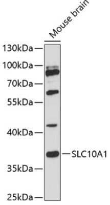 Western Blot: SLC10A1 AntibodyAzide and BSA Free [NBP2-93184]