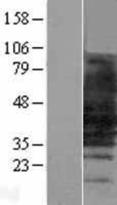 Western Blot: SLC10A1 Overexpression Lysate [NBL1-16003]