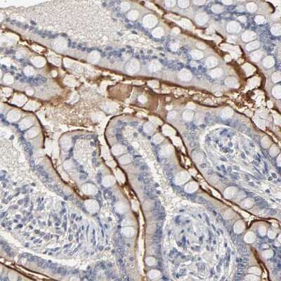 Immunohistochemistry-Paraffin: SLC10A2 Antibody [NBP1-88813]