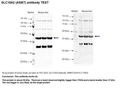 Western Blot: SLC10A2 AntibodyAzide and BSA Free [NBP2-93416]