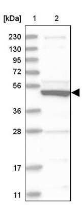 Western Blot: SLC10A3 Antibody [NBP1-84957]