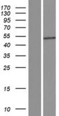 Western Blot: SLC10A3 Overexpression Lysate [NBP2-06706]