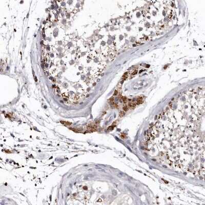 Immunohistochemistry-Paraffin: SLC10A4 Antibody [NBP1-81134]