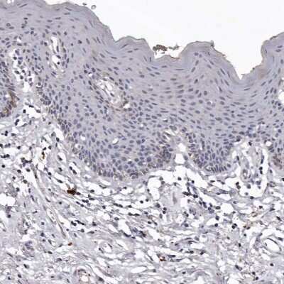 Immunohistochemistry-Paraffin: SLC10A4 Antibody [NBP1-81134]