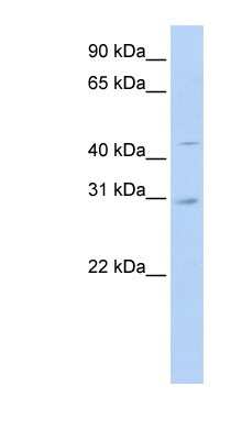 Western Blot: SLC10A4 Antibody [NBP1-59401]