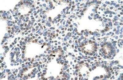 Immunohistochemistry-Paraffin: SLC10A5 Antibody [NBP1-59707]