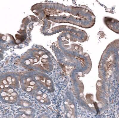 Immunohistochemistry-Paraffin: SLC10A5 Antibody [NBP1-85965]