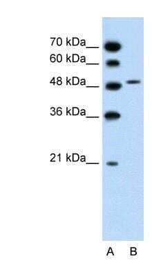 Western Blot: SLC10A5 Antibody [NBP1-59707]